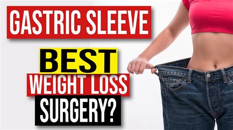 rate what does sleeve mean weight loss